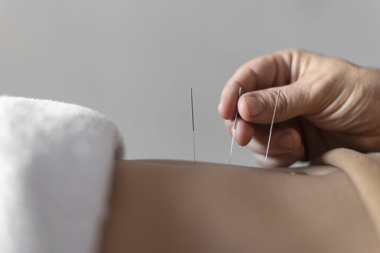 fisioterapi-effective-herniated-discs