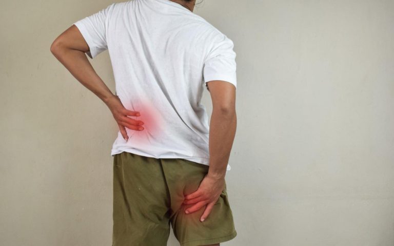sciatica