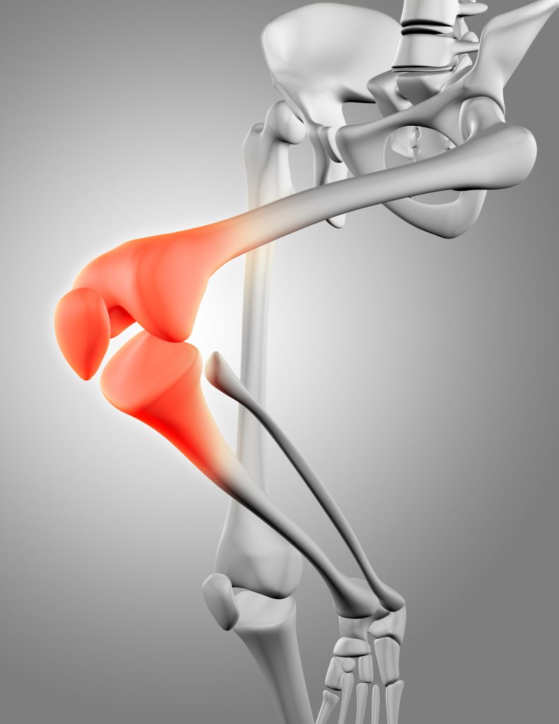 effective-ways-tkr-treatment